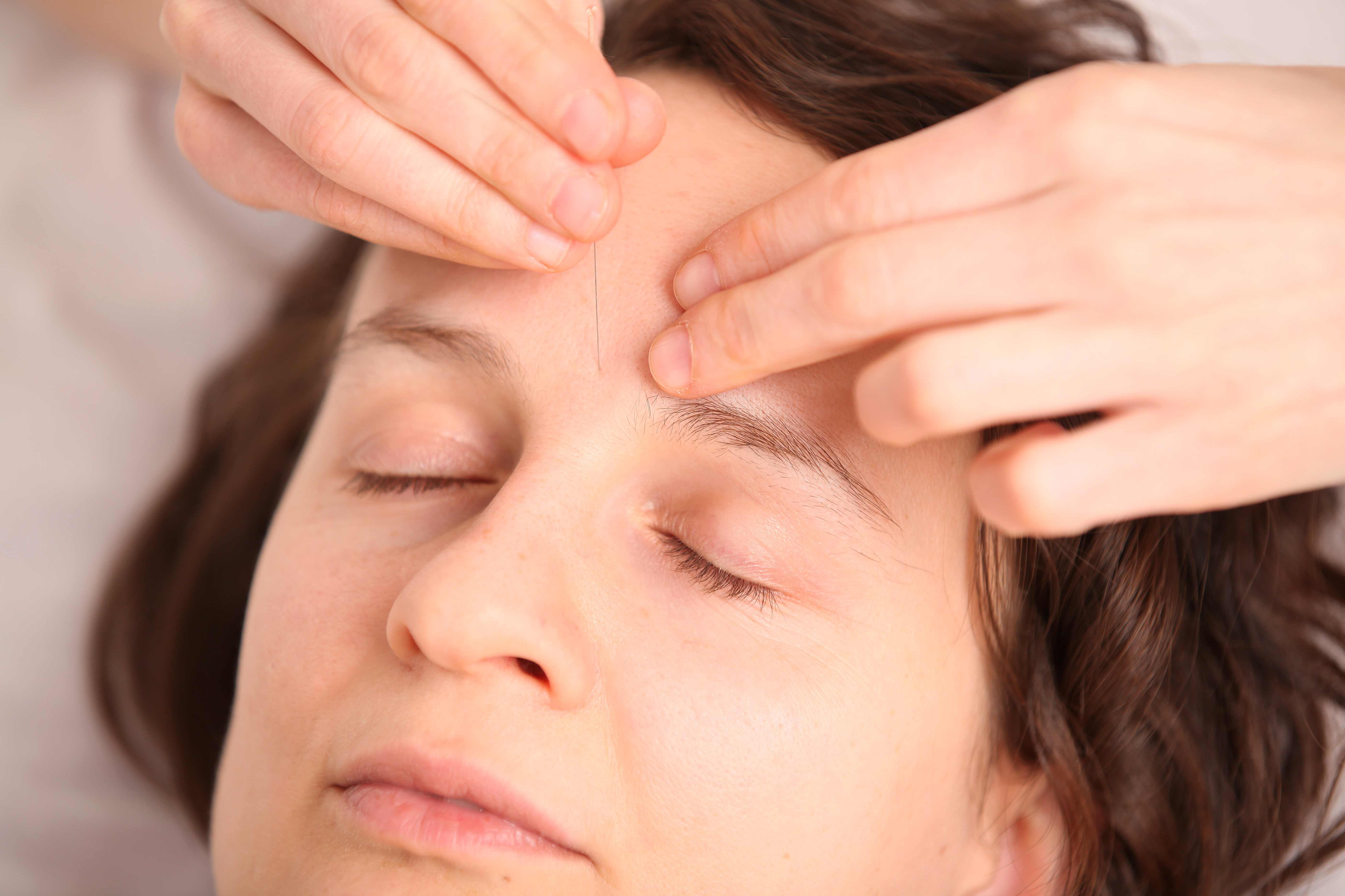 Akupunktur Gesichtsbehandlung